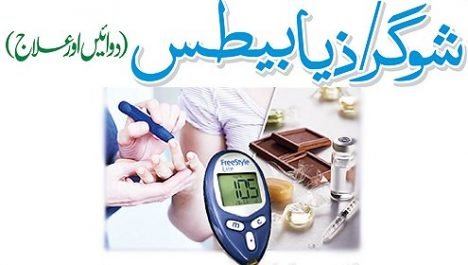 شوگر (ذیابیطس): اسباب، علامات، علاج، ہومیوپیتھی، غذا، ورزش اور مکمل رہنمائی