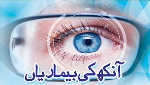 آنکھ کی بیماریاں