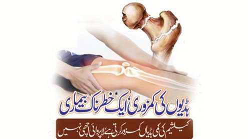 ہڈیوں کی کمزوری