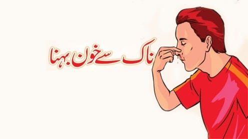 نکسیر