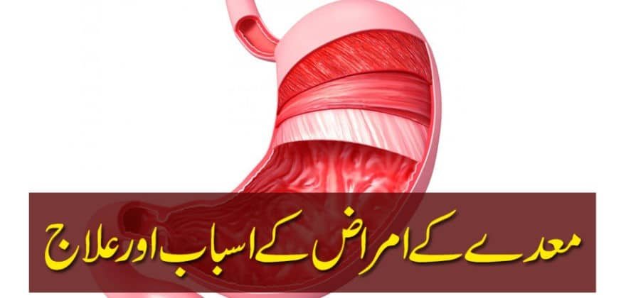 Stomach Acidity: Causes and Treatment