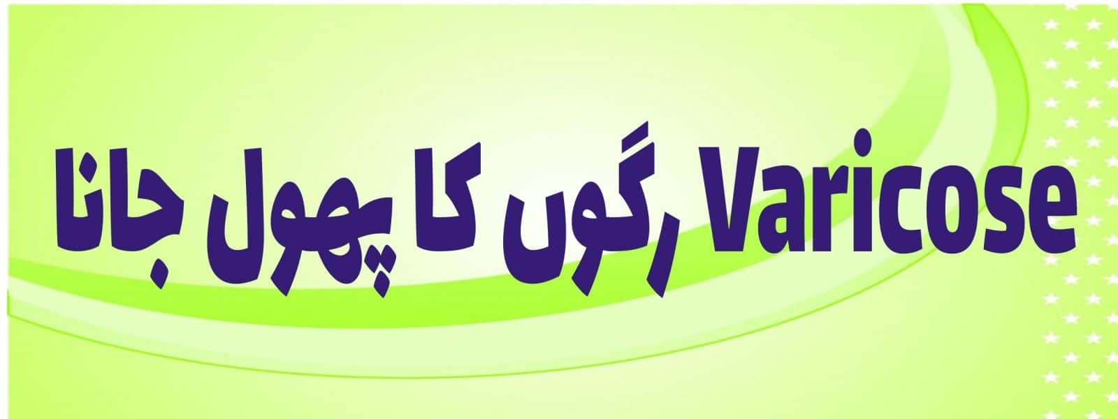 رگوں کا پھول جانا Varicose
