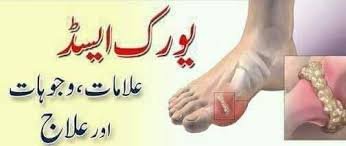 Uric acid Homeopathic Treatment