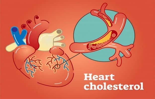 Blood Clots