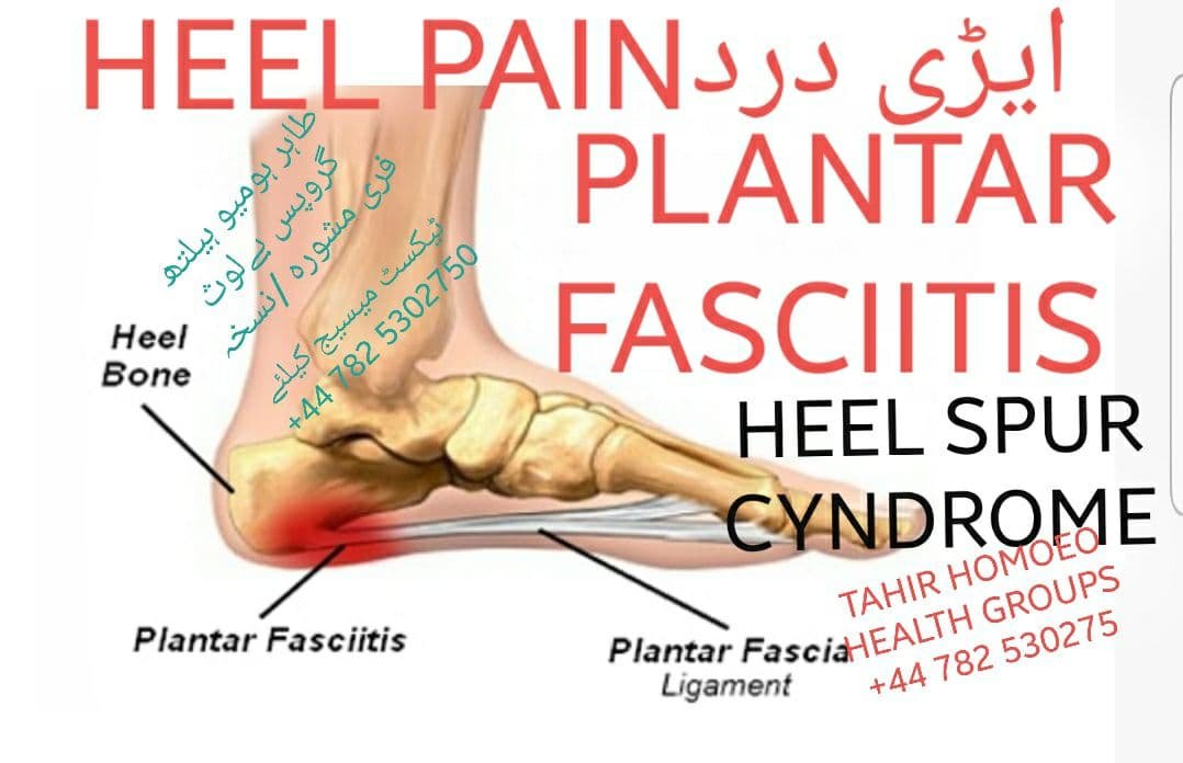 ‎ایڑی کا درد/PLANTAR/ FASCIITIS /  HEEL SPUR SYNDROME