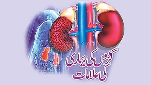 امراض گردہ کا تفصیلی علاج