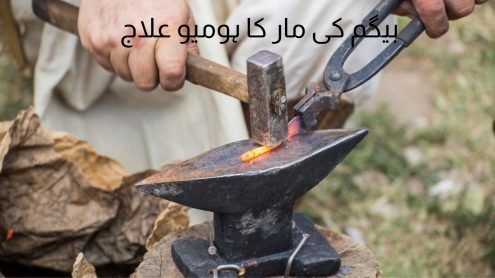 بیگم کامار کا ہومیو پیتھک علاج